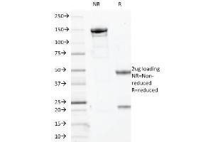 SDS-PAGE Analysis Purified p63 Mouse Monoclonal Antibody (TP63/2427). (p63 antibody)
