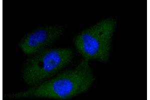 Immunofluorescence analysis of PC-3M cells using CASP3 antibody (ABIN4903137). (Caspase 3 antibody)