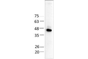 Aminoadipate Aminotransferase (AADAT) (AA 30 - 425), fraction 11 - 12 (AADAT Protein (AA 30-425) (His tag))