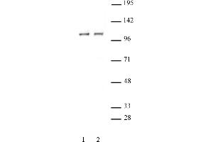 Western Blotting (WB) image for anti-Signal Transducer and Activator of Transcription 2, 113kDa (STAT2) (C-Term) antibody (ABIN6972802)
