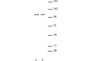 STAT2 antibody (pAb) tested by Western blot. (STAT2 antibody  (C-Term))