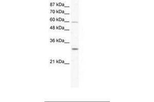 Image no. 1 for anti-DEAD (Asp-Glu-Ala-Asp) Box Polypeptide 31 (DDX31) (AA 140-189) antibody (ABIN203216) (DDX31 antibody  (AA 140-189))