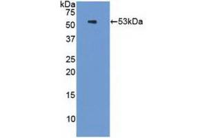 Western blot analysis of recombinant Human PSMC3. (PSMC3 antibody  (AA 2-439))