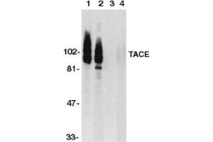 Image no. 1 for anti-ADAM Metallopeptidase Domain 17 (ADAM17) (C-Term) antibody (ABIN201454) (ADAM17 antibody  (C-Term))