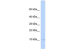 WB Suggested Anti-SUMO3 Antibody Titration: 0. (SUMO3 antibody  (Middle Region))
