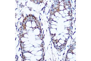 Immunohistochemistry of paraffin-embedded human tonsil using PLK1 Rabbit mAb (ABIN7269436) at dilution of 1:100 (40x lens). (PLK1 antibody)