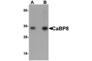 Western blot analysis of CaBP8 in 3T3 cell lysate with CaBP8 antibody at (A) 1 and (B) 2 μg/ml. (Calneuron 1 antibody  (N-Term))
