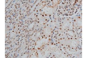 ABIN6268991 at 1/200 staining human kidney tissue sections by IHC-P. (PPP1R12A antibody  (pThr853))