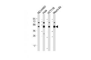 All lanes : Anti-SLC16A3 Antibody (C-term) at 1:1000-1:2000 dilution Lane 1: NCI- whole cell lysate Lane 2: Hela whole cell lysate Lane 3: HC whole cell lysate Lane 4: Neuro-2a whole cell lysate Lysates/proteins at 20 μg per lane. (SLC16A3 antibody  (C-Term))