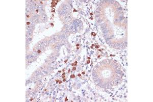 Immunohistochemistry of paraffin-embedded human colon using CD82 antibody (ABIN6131855, ABIN6138233, ABIN6138234 and ABIN6218884) at dilution of 1:100 (40x lens). (CD82 antibody  (C-Term))
