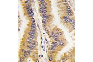 Image no. 1 for anti-Frequently Rearranged in Advanced T-Cell Lymphomas (FRAT1) (C-Term) antibody (ABIN356924) (FRAT1 antibody  (C-Term))