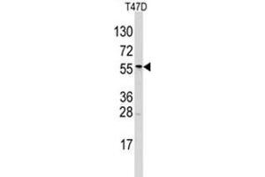 Image no. 1 for anti-Aldehyde Dehydrogenase 6 Family, Member A1 (ALDH6A1) (N-Term) antibody (ABIN356978)