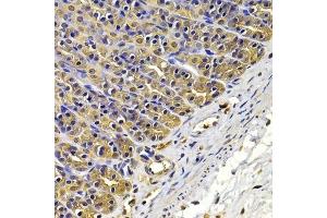 Immunohistochemistry of paraffin-embedded rat stomach using FSCN1 antibody. (Fascin antibody  (AA 394-493))