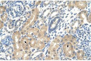 Rabbit Anti-KHK Antibody  Paraffin Embedded Tissue: Human Kidney Cellular Data: Epithelial cells of renal tubule Antibody Concentration: 4. (Ketohexokinase antibody  (C-Term))