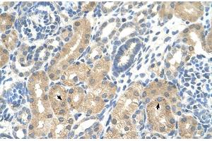 Rabbit Anti-KHK Antibody  Paraffin Embedded Tissue: Human Kidney Cellular Data: Epithelial cells of renal tubule Antibody Concentration: 4.
