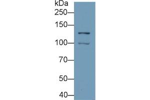 Detection of HIF1a in Hela cell lysate using Monoclonal Antibody to Hypoxia Inducible Factor 1 Alpha (HIF1a) (HIF1A antibody  (AA 218-506))