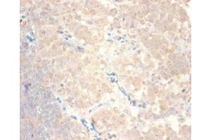 Immunohistochemistry of paraffin-embedded human lymph node tissue using ABIN7145987 at dilution of 1:100 (CCL24 antibody  (AA 27-119))