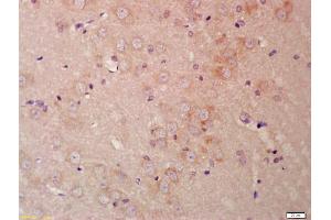 Formalin-fixed and paraffin embedded rat brain labeled with Anti-Frizzled 9/CD349 Polyclonal Antibody, Unconjugated (ABIN1386280) at 1:200 followed by conjugation to the secondary antibody and DAB staining (FZD9 antibody  (AA 185-270))