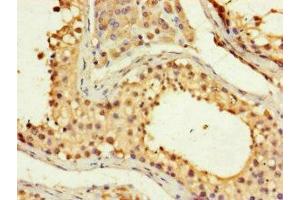 Immunohistochemistry of paraffin-embedded human testis tissue using ABIN7153118 at dilution of 1:100 (Formin-Like 3 antibody  (AA 2-212))