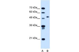 WB Suggested Anti-COL6A2 Antibody Titration:  1. (COL6A2 antibody  (C-Term))