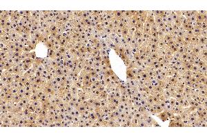 Detection of GSTa3 in Rat Liver Tissue using Polyclonal Antibody to Glutathione S Transferase Alpha 3 (GSTa3)