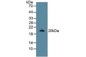 Detection of RSPO1 in Rat Uterus Tissue using Polyclonal Antibody to R-Spondin 1 (RSPO1) (RSPO1 antibody  (AA 136-262))