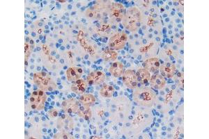 Used in DAB staining on fromalin fixed paraffin- embedded kidney tissue (GSTA1 antibody  (AA 2-222))