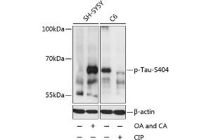 Western blot analysis of extracts of SH-SY5Y and C6 cells, using Phospho-Tau-S404 antibody (ABIN3019703, ABIN3019704, ABIN3019705 and ABIN1681813) at 1:2000 dilution. (MAPT antibody  (pSer404))