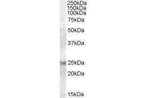 Image no. 1 for anti-RAB8A, Member RAS Oncogene Family (RAB8A) (C-Term) antibody (ABIN374945) (RAB8A antibody  (C-Term))