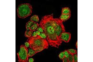 Immunofluorescence analysis of Eca109 cells using CDK1 mouse mAb (green). (CDK1 antibody)