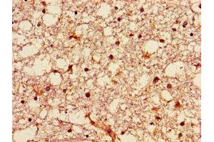Immunohistochemistry of paraffin-embedded human brain tissue using ABIN7149942 at dilution of 1:100 (GNPAT antibody  (AA 589-680))