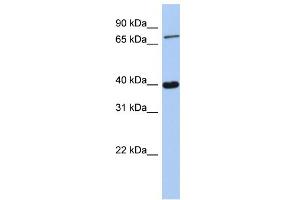WB Suggested Anti-PRDM4 Antibody Titration:  0. (PRDM4 antibody  (C-Term))