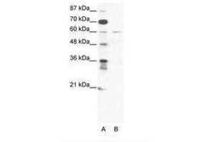 Image no. 1 for anti-Zinc Finger Protein 92 (ZNF92) (C-Term) antibody (ABIN203188) (ZNF92 antibody  (C-Term))