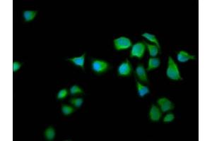 Immunofluorescence staining of Hela cells with ABIN7167153 at 1:66, counter-stained with DAPI. (RASAL2 antibody  (AA 749-835))