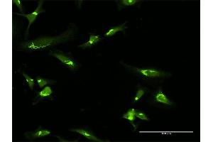 Immunofluorescence of purified MaxPab antibody to GOLGA2 on HeLa cell.