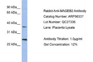 WB Suggested Anti-MAGEB2  Antibody Titration: 0.