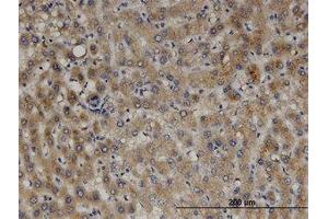 Image no. 1 for anti-Peroxisomal Biogenesis Factor 11 beta (PEX11B) (AA 1-99) antibody (ABIN599479) (PEX11B antibody  (AA 1-99))
