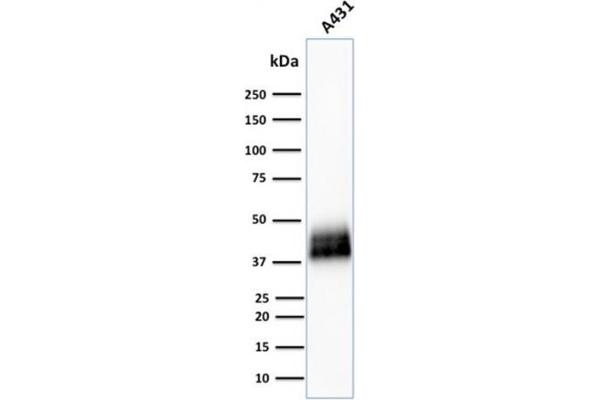 TACSTD2 抗体  (AA 31-274)
