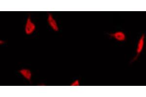 ABIN6267495 staining Hela by IF/ICC. (PPARG antibody  (pSer112))