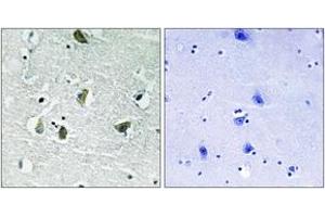 Immunohistochemistry analysis of paraffin-embedded human brain, using JAK2 (Phospho-Tyr931) Antibody. (JAK2 antibody  (pTyr931))