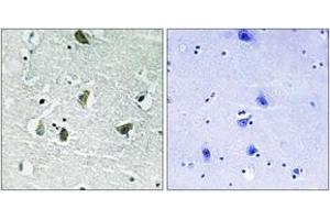 Immunohistochemistry (IHC) image for anti-Janus Kinase 2 (JAK2) (AA 906-955), (pTyr931) antibody (ABIN1532051)
