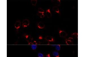 Confocal immunofluorescence analysis of Hela cells using USO1 Polyclonal Antibody at dilution of 1:200. (USO1 antibody)