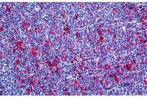 Human Tonsil: Formalin-Fixed, Paraffin-Embedded (FFPE) (Gelsolin antibody  (AA 673-783))