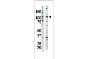 Image no. 1 for anti-Mitogen-Activated Protein Kinase Kinase Kinase 9 (MAP3K9) (C-Term) antibody (ABIN360307) (MAP3K9 antibody  (C-Term))