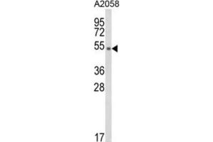 Western Blotting (WB) image for anti-Disabled Homolog 2, Mitogen-Responsive phosphoprotein (Drosophila) (DAB2) antibody (ABIN3003993)