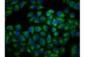 Immunofluorescence staining of Hela cells with ABIN7143334 at 1:133, counter-stained with DAPI. (ADCY6 antibody  (AA 9-118))