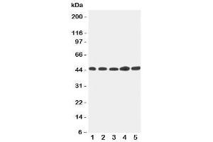 Western blot testing of Hepsin antibody and Lane 1:  293T (Hepsin antibody  (C-Term))