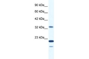 WB Suggested Anti-ZNF688 Antibody Titration:  2. (ZNF688 antibody  (Middle Region))