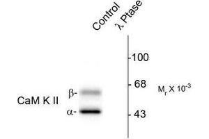 Image no. 1 for anti-Calcium/calmodulin-Dependent Protein Kinase II alpha (CAMK2A) (pThr286) antibody (ABIN372594) (CAMK2A antibody  (pThr286))