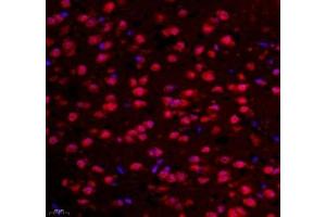 Immunofluorescence of paraffin embedded mouse prefrontal lobe using NCBP2 (ABIN7074870) at dilution of 1: 650 (400x lens) (NCBP2 antibody)